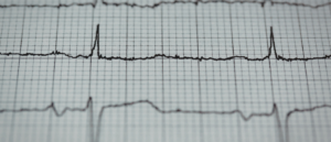 What Are Shockable Rhythms On An AED
