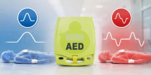 Monophasic Vs. Biphasic AED Shocks Explained